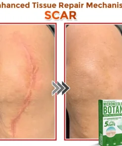 DermaPatchRX® MicroNeedle Botanic Skin Tag Removal Patch