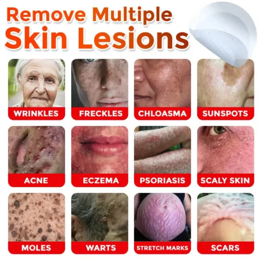 DermaPatchRX® MicroNeedle Botanic Skin Tag Removal Patch