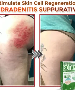 DermaPatchRX® MicroNeedle Botanic Skin Tag Removal Patch