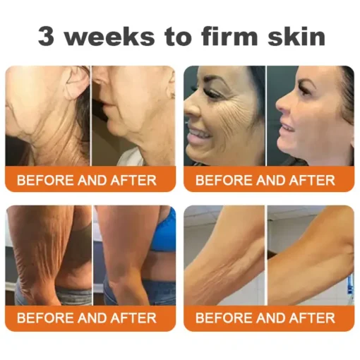 NEGUSY® Peptide Complex Age-Defying Skin Restorative Cream