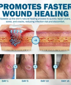 NEGUSY™ Skincare Designed for Diabetic Patients