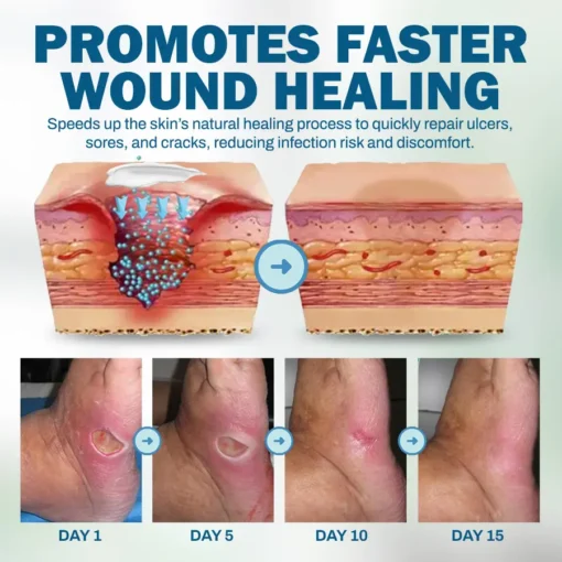 NEGUSY™ Skincare Designed for Diabetic Patients