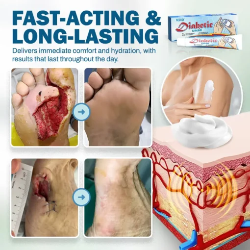 NEGUSY™ Skincare Designed for Diabetic Patients