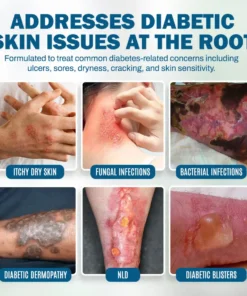 NEGUSY™ Skincare Designed for Diabetic Patients