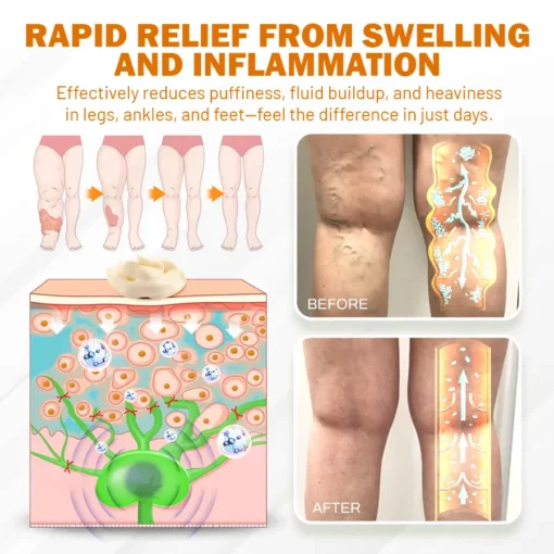 NEGUSY™ Boost Circulation and Relieve Swelling