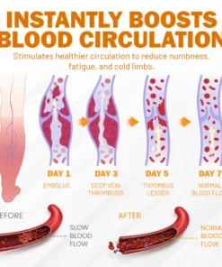NEGUSY™ Boost Circulation and Relieve Swelling
