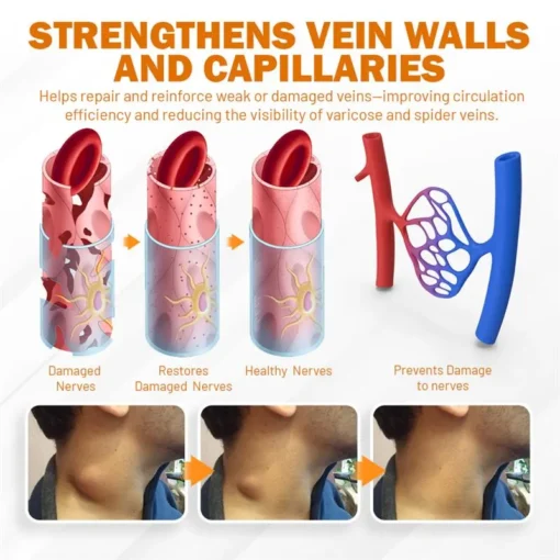 NEGUSY™ Boost Circulation and Relieve Swelling