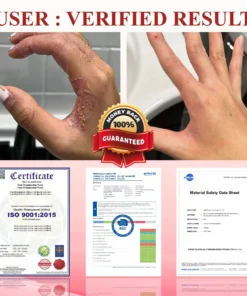 NEGUSY® GlucoseGuard Skin Rescue Cream