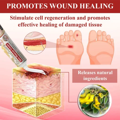 NEGUSY® GlucoseGuard Skin Rescue Cream