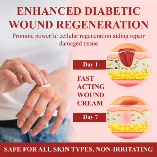 NEGUSY® GlucoseGuard Skin Rescue Cream