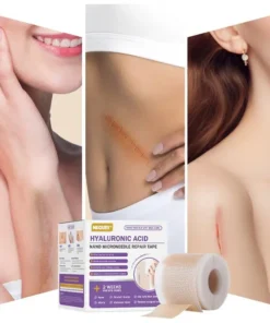 NEGUSY® Hyaluronic Acid Nano Microneedle Repair Tape
