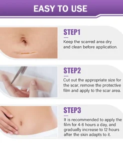 NEGUSY® Hyaluronic Acid Nano Microneedle Repair Tape