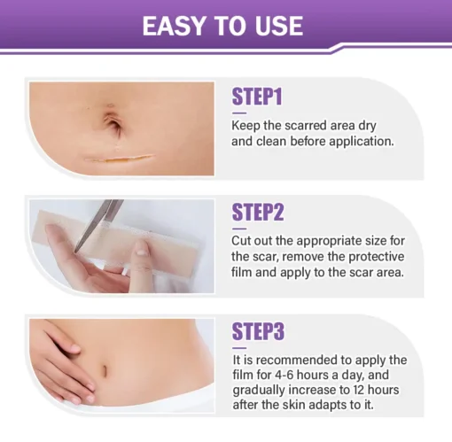 NEGUSY® Hyaluronic Acid Nano Microneedle Repair Tape