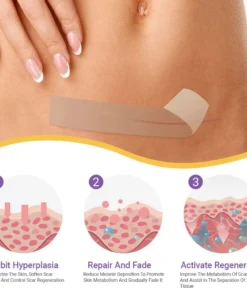 NEGUSY® Hyaluronic Acid Nano Microneedle Repair Tape