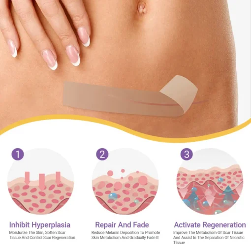 NEGUSY® Hyaluronic Acid Nano Microneedle Repair Tape