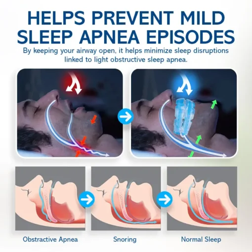NEGUSY™ Silent Sleep Mouthpiece