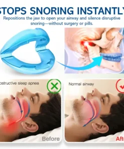 NEGUSY™ Silent Sleep Mouthpiece