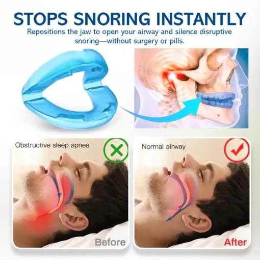 NEGUSY™ Silent Sleep Mouthpiece