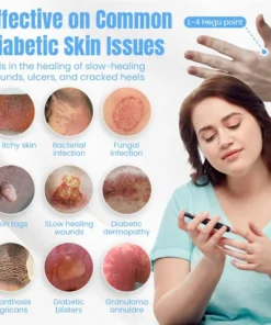 NEGUSY™ Sugar Control Acupressure Point Clip