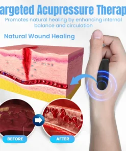 NEGUSY™ Sugar Control Acupressure Point Clip