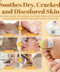 NEGUSY™ Sugar Control Toe Rings