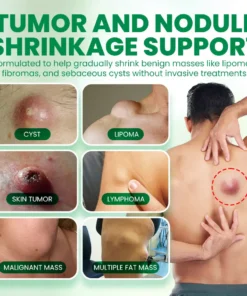 NEGUSY™Advanced Lipoma & Nodule Treatment Cream