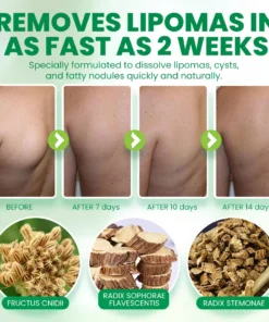 NEGUSY™Advanced Lipoma & Nodule Treatment Cream