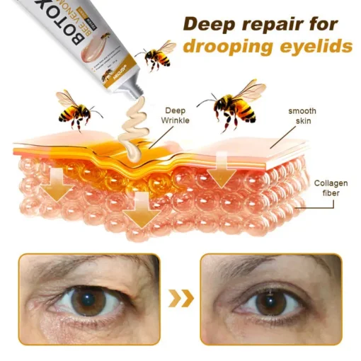 NEGUSY® Botox Bee Venom Wrinkle Removal Cream
