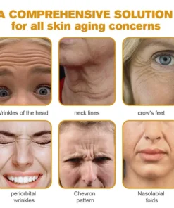 NEGUSY® Botox Bee Venom Wrinkle Removal Cream