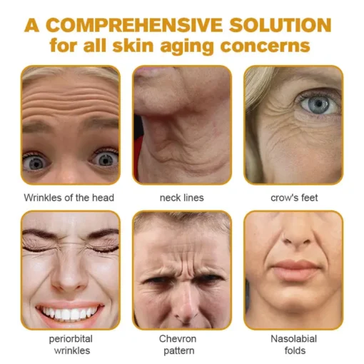 NEGUSY® Botox Bee Venom Wrinkle Removal Cream