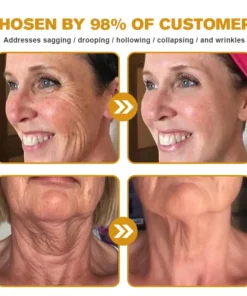 NEGUSY® Botox Bee Venom Wrinkle Removal Cream
