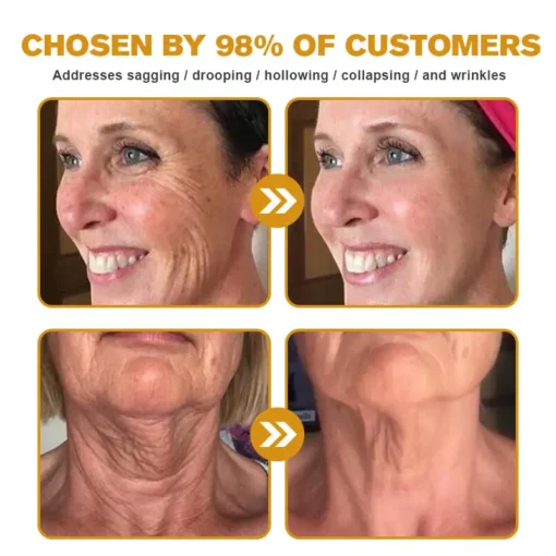 NEGUSY® Botox Bee Venom Wrinkle Removal Cream