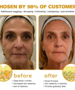 NEGUSY® Botox Bee Venom Wrinkle Removal Cream