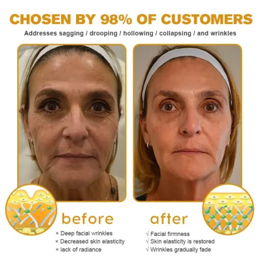 NEGUSY® Botox Bee Venom Wrinkle Removal Cream