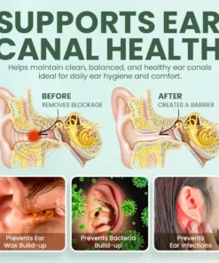 NEGUSY™ Ear Care Solution