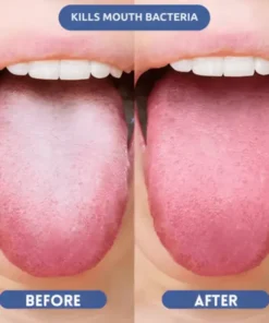 NEGUSY™ Probiotic Oral Mist