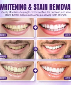 NEGUSY™ Teeth Restoration Mineral Powder