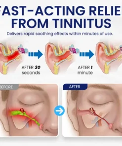 NEGUSY™ Tinnitus Relief Drops