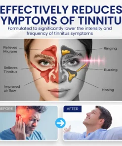 NEGUSY™ Tinnitus Relief Drops