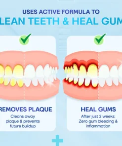 Negusy™ Gum Therapy Agent