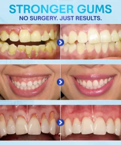 Negusy™ Gum Therapy Agent