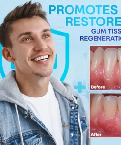 Negusy™ Gum Therapy Agent