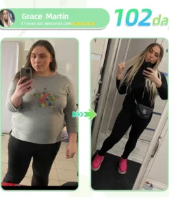 Negusy™ SMGT-GLP-1 Nano Microneedle Patch