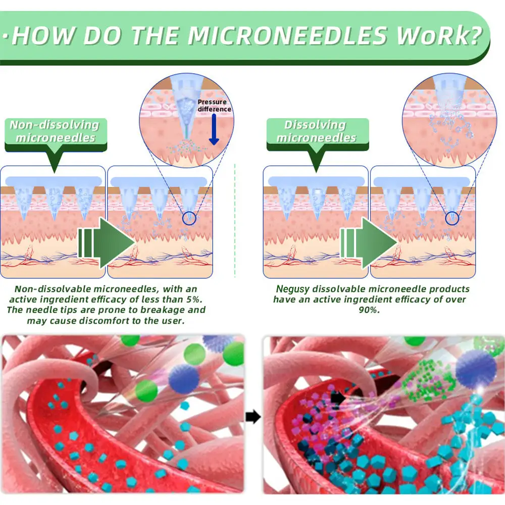 Negusy™ SMGT-GLP-1 Nano Microneedle Patch