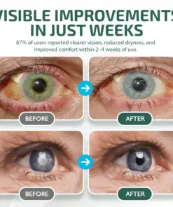 NEGUSY™ Nano Eye Drops Serum