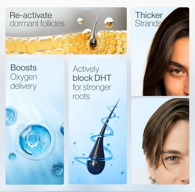 NEGUSY Hair Growth Serum Roll-On: The Scalp-Supporting Solution for Thicker, Fuller Hair