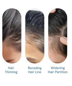 NEGUSY Hair Growth Serum Roll-On: The Scalp-Supporting Solution for Thicker, Fuller Hair