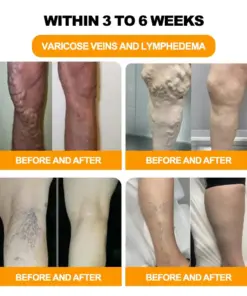 NEGUSY™ 30-Herb Slimming & Detox Foot Bath Beads