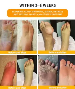 NEGUSY™ 30-Herb Slimming & Detox Foot Bath Beads